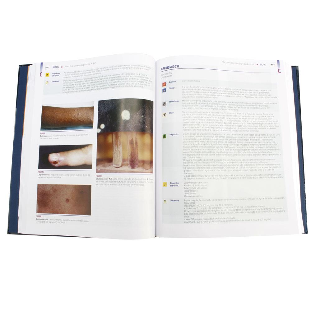 atlas de dermatologia azulay